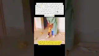 One leg, but full of dignity #foryou #video #shorts #shortsviral #shortvideo #viralshort #views #art
