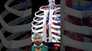 Surgical animation #doctor #anatomy #technology #hospital #cardiachealth #medicalart