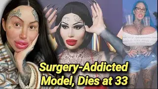 Mary Magdalene Dead at 33 | Plastic Surgery Influencer Dies | Cause Of Death | Model Died