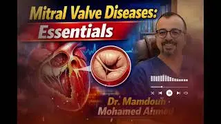 Mitral stenosis: Essentials - Dr. Mamdouh Mohamed Ahmed MRCP-UK 