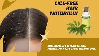 👧Anti-Lice Remedy | Neem + Camphor Oil for Lice-Free Hair #trending #viral #youtube