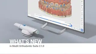 What's New in Medit Orthodontic Suite v2.1.0