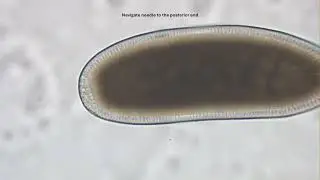 Primordial Germ Cell Collection in Drosophila melanogaster