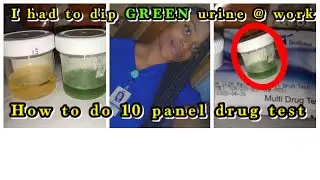 HOW TO DO 10 PANEL URINE DRUG TEST + GREEN urine at work + Day in the life of a medical assistant