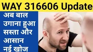 Way 316606 update  || cost of way 316606 || Hairloss Treatment || way 316606 in india ||