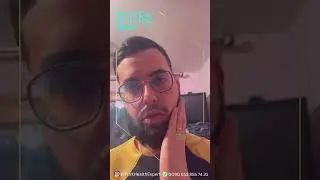 TRANSFORMATION INCROYABLE 🤯 Greffe de Barbe &agrave; Turk Health Expert