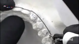 First Order Bend (In & Out Bend)