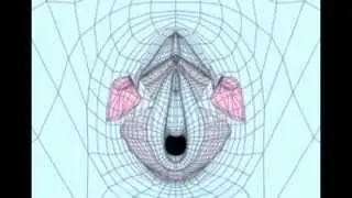 Vaginal Labiaplasty Explained - Wedge Method