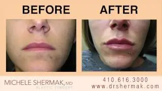 Michele Shermak - Board Certified Plastic Surgeon in Baltimore Maryland