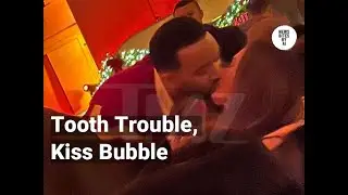 Chrissy Teigen&rsquo;s Tooth Mishap Ends With a Makeout Moment With John Legend
