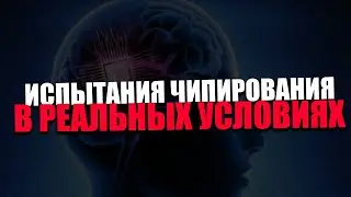 NEUROETHICS. How do pseudo-humanistic ideas blur the understanding of humanity?