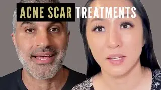 Which Acne Scar Treatments Are The Best?