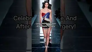 Celebrities before and after plastic surgery (Part 1). #shorts
