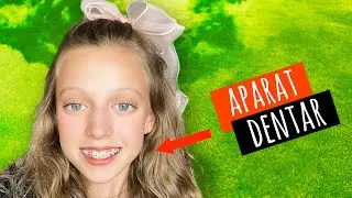 😬 Cum Și-a Pus APARAT DENTAR