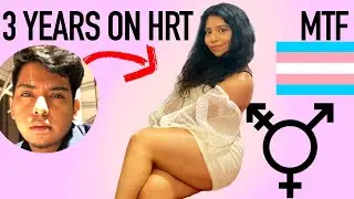 🏳️&zwj;⚧️ 3 YEARS ON HORMONES MALE TO FEMALE TRANSGENDER | PHSYCIAL & MENTAL CHANGES + SELF IMPROVEMENT