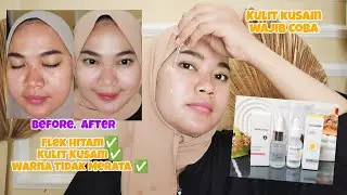 Whitelab Brightening serum Vs Whitestory Brightening serum | Review serum untuk mencerahkan wajah