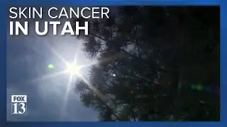 Study cites skin cancer rates in Utah as being the highest in the country