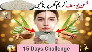 حسنِ یوسف کریم گھر پر بنائیں | 15 دن میں چہرہ صاف، گورا اور بے داغ |  Acne, Pimples & Dark Spots 
