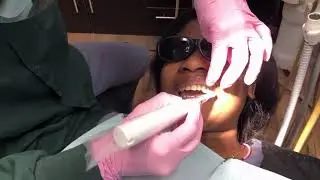 iStar Cordless Prophy Handpiece Testimonial
