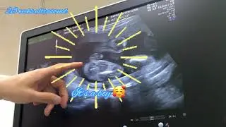 23 WEEKS PREGNANT 4D ULTRASOUND | Baby boy pregnancy update!