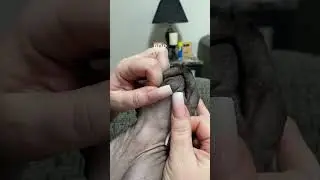 #satisfying #pimple #pimplepop #black #pop #pimplepopper #squeeze #satisfying #s