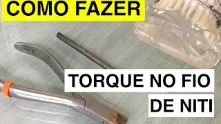 Como fazer TORQUE INDIVIDUAL no FIO de NiTi - Será possível? - Ortodontia com o prof. Hélio Venâncio