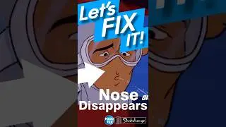 Missing Nose! - GI Joe ToonFix!