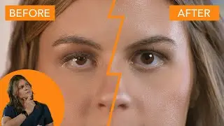 Non-Surgical Eye Lid Lift?