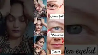 Faller eyelid, #laughing lines, #antiaging #viralvideo #faceyoga #beauty #shorts #faceexercises ❤️👍🏽