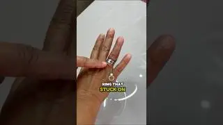 A doctor showed me how to remove the ring that was stuck on my finger! It's amazing #shorts #tips