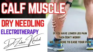 Dry Needling |Gastrocnemius | Lower leg pain management| Shahid ortho & Rehab center| Trigger points