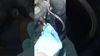 Mercedes P0355 P0305 solution.