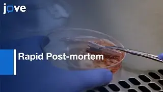 Rapid Post-mortem Cell Culture of DIPG | Protocol Preview