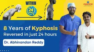 Life-Changing Spine Surgery : 8 Years of Kyphosis Reversed in just 24 hours by Dr. Abhinandan Reddy
