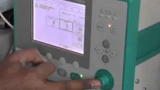Réglage initial du Fabian pour la CPAP du nouveau-né