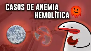 DESAFÍA tu CONOCIMIENTO con estos CASOS CLÍNICOS de ANEMIA HEMOLÍTICA