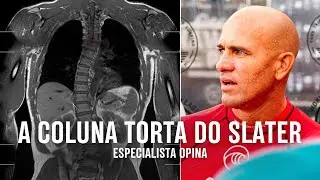 A coluna torta do Kelly Slater - especialista opina na TV Waves
