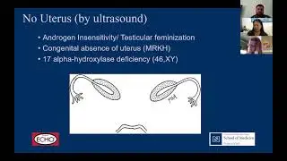 Complex Pediatrics: Identifying and Treating Adolescent Menstrual Issues (7/10/2020)