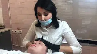 Всесезонное, не инвазивное омоложение лица итальянским пилингом PRXT-33.