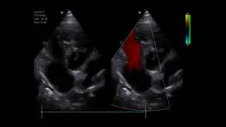 Pulmonary Hypertension in a dog