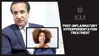 How to Treat Post Inflammatory Hyperpigmentation | Dermatology | ICLS Dermatology & Plastic Surgery