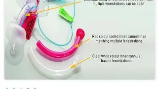 Tracheostomy Bite size part 1 Tubes