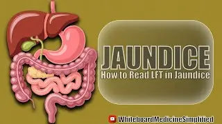 What is Jaundice? Causes, Types, Investigations #jaundice #youtube #medstudent #usmle #neetpg 