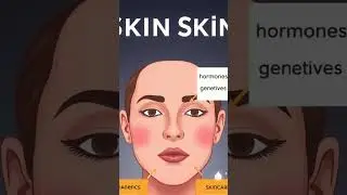 Clearing the Chocolate Acne Misconception