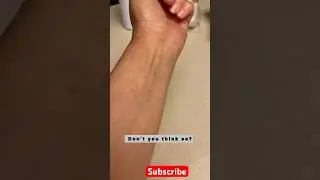Psoriasis Natural Cure for me- Anti Inflammatory Drink for flare ups