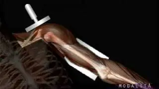 fisioghio.com. tecar - colonna