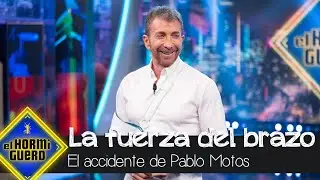 Pablo Motos desvela c&oacute;mo fue el accidente por el que casi pierde fuerza del brazo - El Hormiguero
