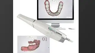 The Accuracy Of Intra Oral Scanner