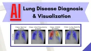 AI-Driven Lung Disease Diagnosis using U-Net Image Segmentation and Class Activation Mapping (CAM)