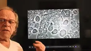 Cure Gum Disease, get rid of your periodontitis Parasites. Dr Mark Bonner method Live